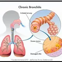 Профилактика ОРЗ, ОРВИ