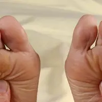 К здоровью — через стопы. Осень