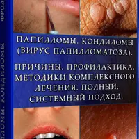 Папилломы. Кондиломы. Причины. Профилактика. Лечение