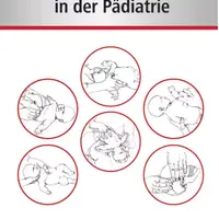 Практический учебник по Модели фасциальных нарушений (FDM) в педиатрии
