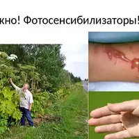 Скоро лето: как уберечься от солнечных лучей?