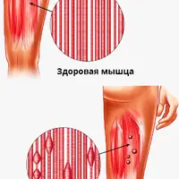 Видеоруководство по избавлению от триггерных точек