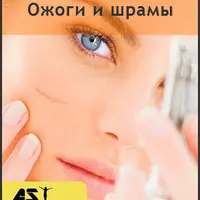 Ожоги и шрамы