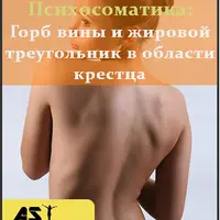 Горб вины и жировой треугольник в области крестца