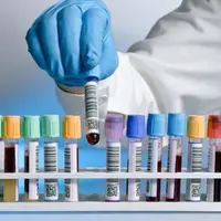 Читаем свои анализы