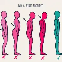 Тренировка при нарушениях осанки