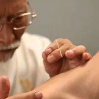 Иглорефлексотерапия. Часть 3