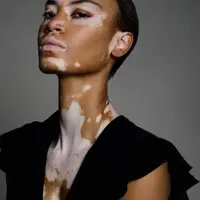 Пигментация