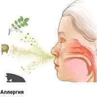 Аллергия