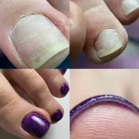 Культура педикюра. Эстетика