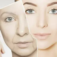 Молодая кожа