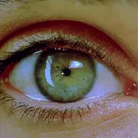 Зеленые Глаза Мощный Плюс +11x