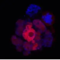 Генерализованные стволовые клетки взрослых