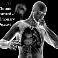 Хроническая обструктивная болезнь легких. Заживление и регенерация