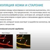 Сосудоукрепляющая косметика