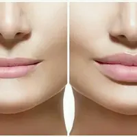 Улучшение губ