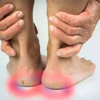 Заживление трещин на пятках и ступнях