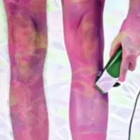 Удаление волос на всем теле