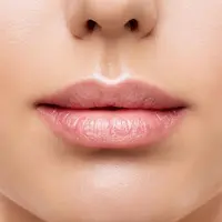 Увеличение губ