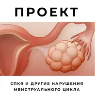 СПКЯ и другие нарушения менструального цикла