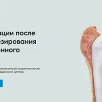 Протокол реабилитации после эндопротезирования тазобедренного сустава