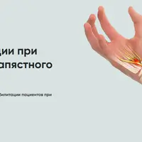 Протокол реабилитации при синдроме запястного канала
