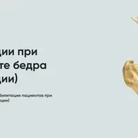 Протокол реабилитации при импиджменте бедра (без операции)