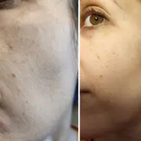 Домашний инструментарий по сохранению красоты и молодости