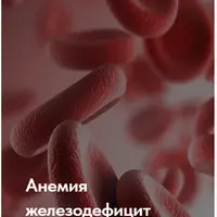 Лечебный протокол "Анемия железодефицит"
