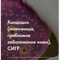 Лечебный протокол: Кандидоз, молочница, грибковые заболевания кожи