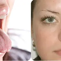 Клуб Здоровье: инструкция к применению. Снижение функции щитовидной железы