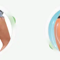 Прощай целлюлит