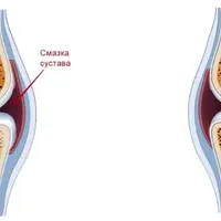 Здоровье суставов ног от А до Я
