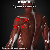 Массаж триггерных точек в плече