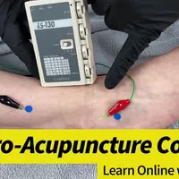 Диплом по электроакупунктуре и электросухой игле