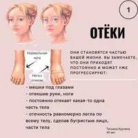 Жизнь без отёков