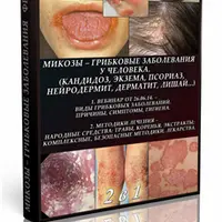 Методики излечения от грибковых заболеваний, кожных и внутренних поражений