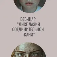 Дисплазия соединительной ткани