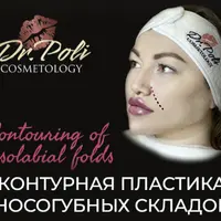 Контурная пластика носогубных складок