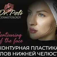 Контурная пластика углов нижней челюсти