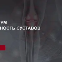 Мобильность суставов