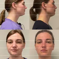 Тренировка лица