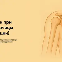Протокол реабилитации при переломе ключицы после операции