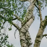 Дисплазия соединительной ткани