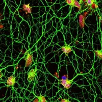 Аномалия или новая парадигма? Кто и как делает научные революции, и почему важно знать, как возникла нервная система