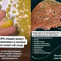 Камнепад. Похудение и омоложение через очищение печени