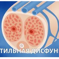 Нарушения половой функции у мужчин. Эректильная дисфункция и её составляющие