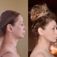 Лекторий. Платформа для практик. Модуль 2. Восстановление лица