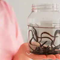 Онлайн практикум по гирудопластике лица