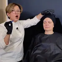 Ботулинотерапия Full-Face